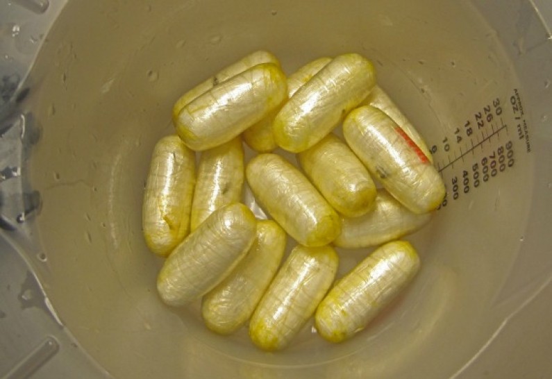 Another Guyanese woman busted at JFK with cocaine pellets in stomach
