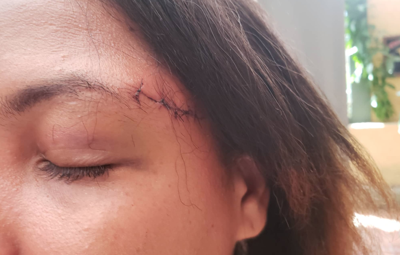 Woman who attacked teacher now under probe for attack on husband’s university classmate