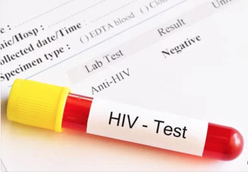 Guyana sees slight decrease in HIV prevalence rate