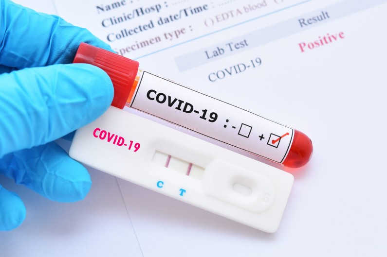 69 New COVID-19 cases and two more deaths recorded