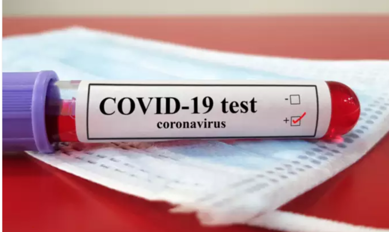 COVID-19 deaths reach 80