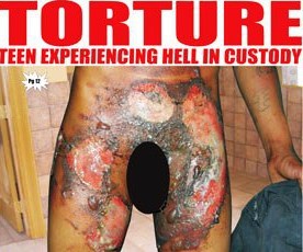 teenager-tortured-by-the-guyana-police-force