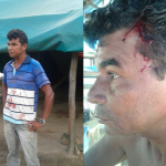 Gold miners attacked  and beaten by other miners and gunmen in mining spot row