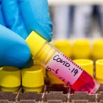 Linden man tests positive for coronavirus