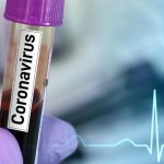 Citizens urged to stay home as COVID-19 Confirmed Cases Climb to 33