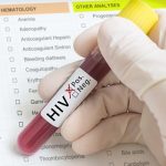 HIV+ persons not on treatment at increased risk for severe form of COVID-19  -NAPS