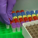 Guyana sends samples to CARPHA for testing for COVID variants
