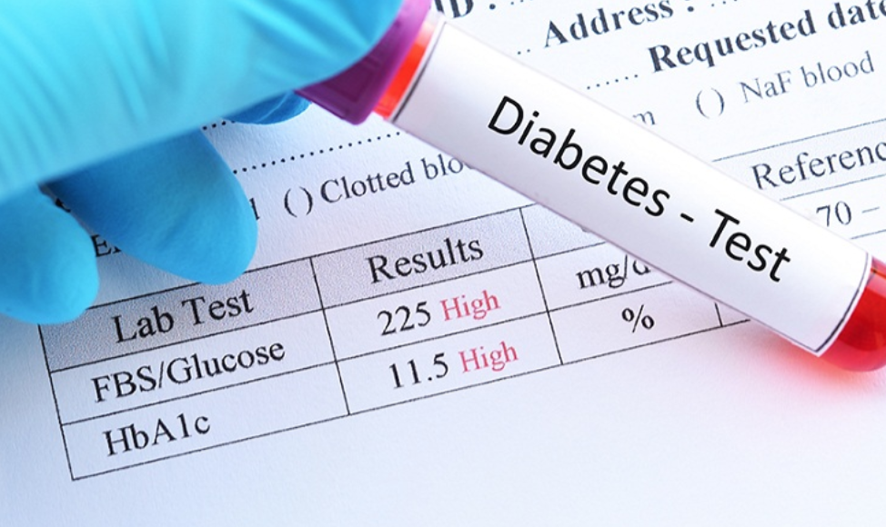 1 in 10 Guyanese affected by Diabetes -Health Ministry reveals – News Source Guyana