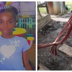 Corentyne girl dies after reportedly falling through hammock