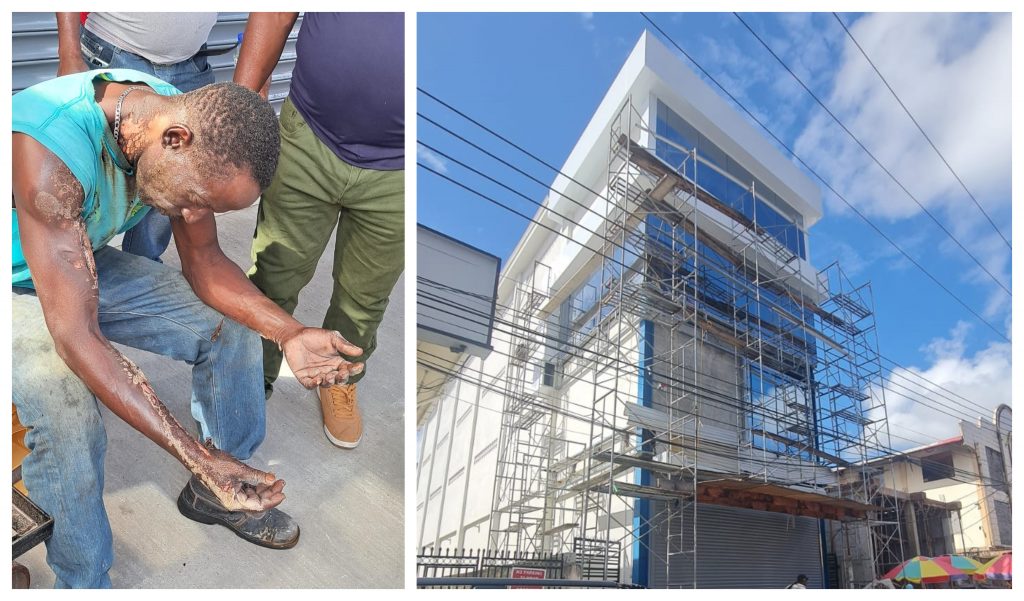 Construction worker seriously injured by electric shock at building site – News Source Guyana