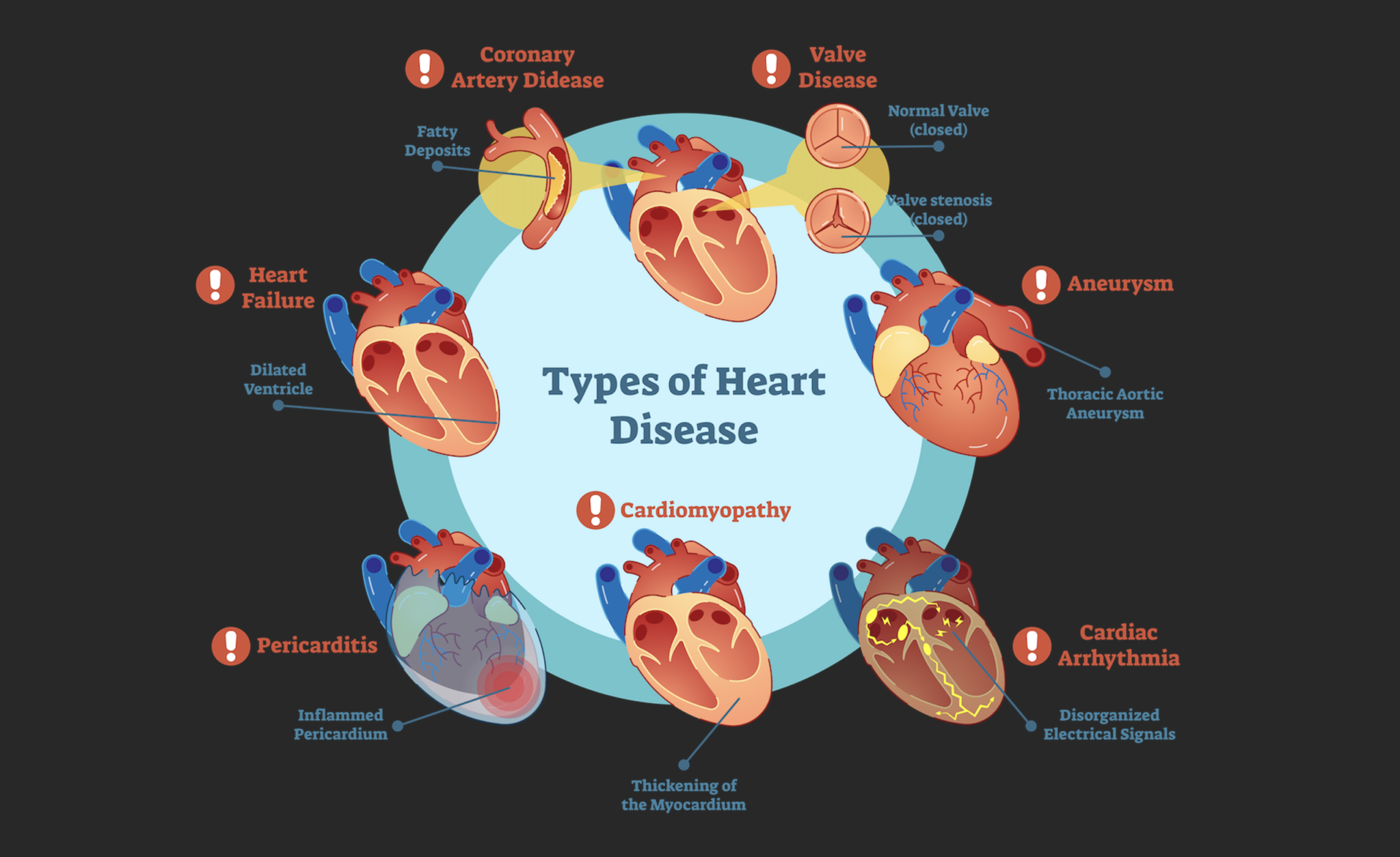 Cardiologist sounds alarm over high number of young persons in Guyana ...